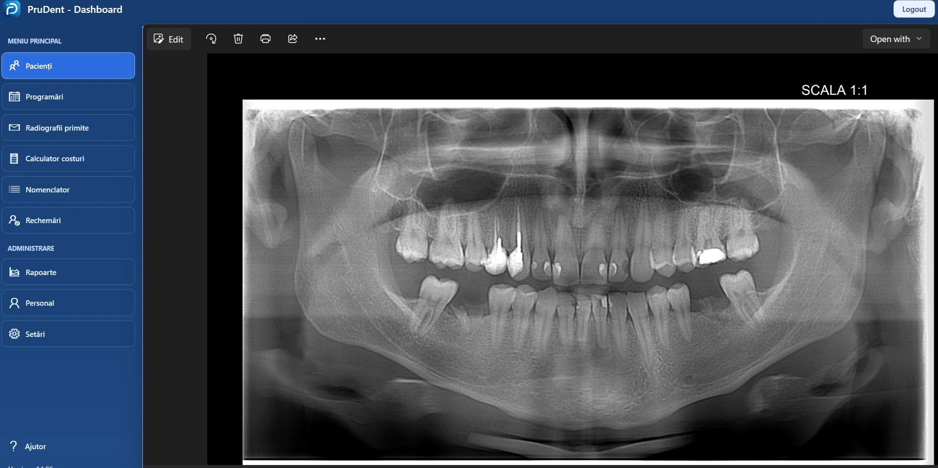 Radiografie panoramică deschisă din fișa pacientului în PruDent